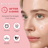 Acne Pimple Master Patch